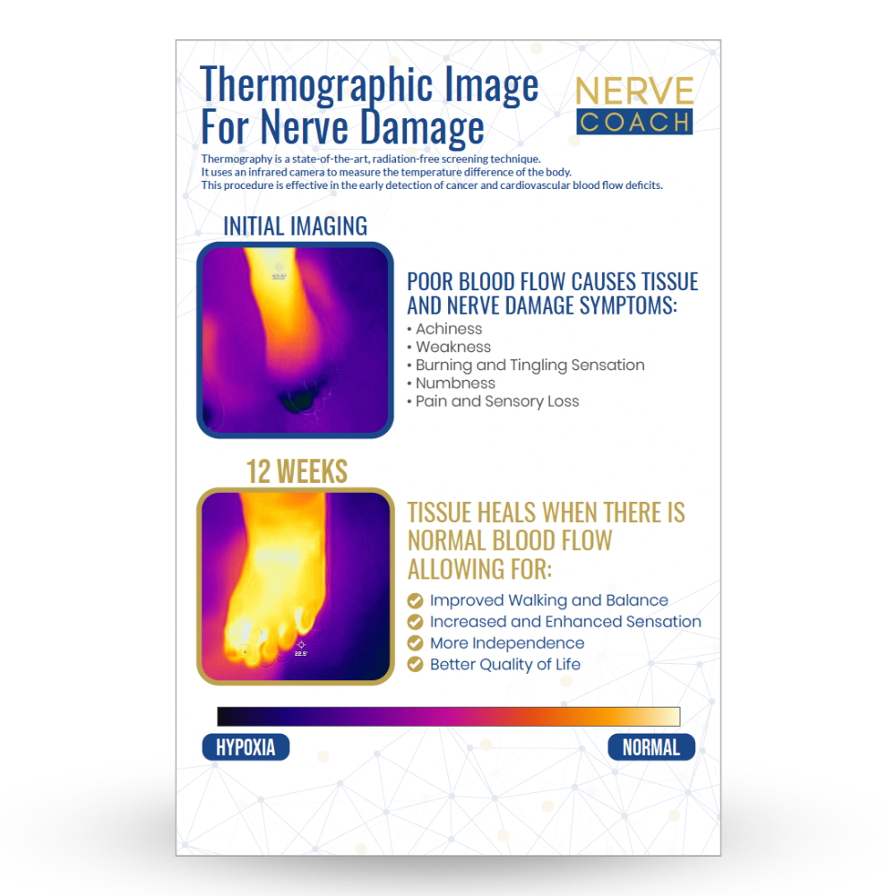 Thermographic Image for Nerve Damage Poster