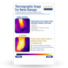 Thermographic Image for Nerve Damage Poster